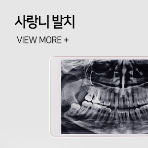 사랑니발치